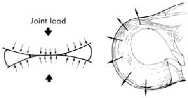Meniscal Surgery